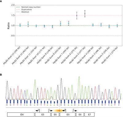 Characterizing PALB2 intragenic duplication breakpoints in a triple-negative breast cancer case using long-read sequencing